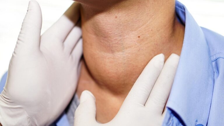 How to Reduce Thyroid Inflammation