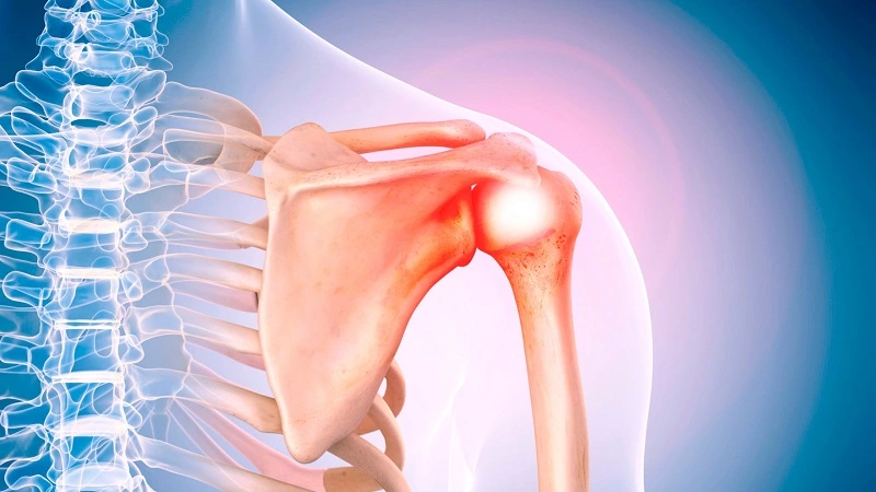 do's and don'ts for frozen shoulder