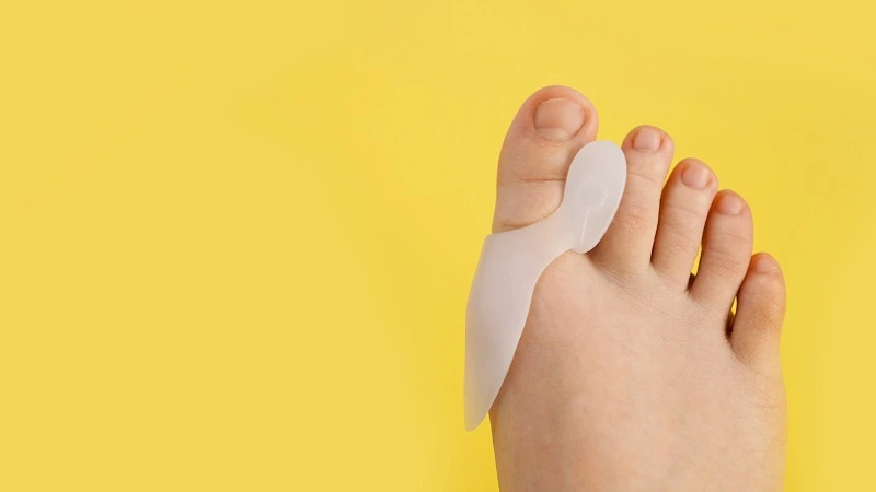 lapiplasty bunion surgery pros and cons