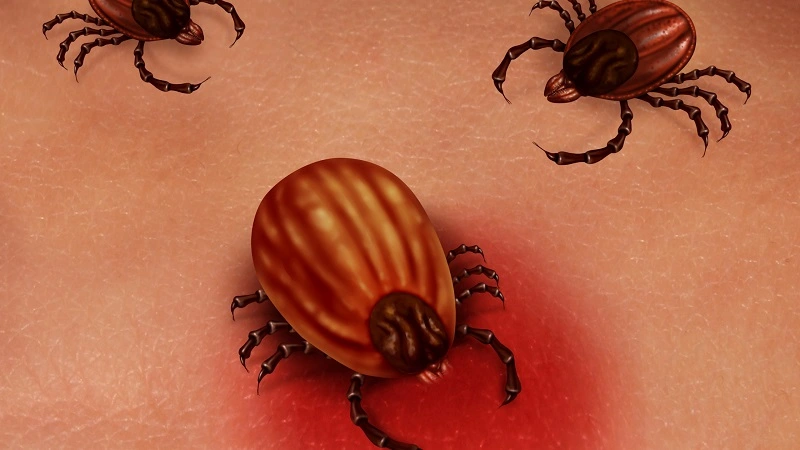 ozone therapy for lyme disease
