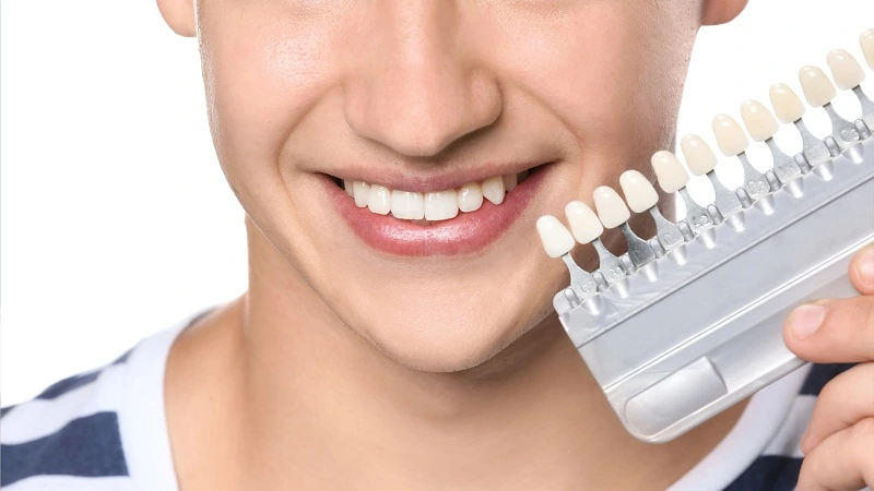 dental veneers for gapped teeth