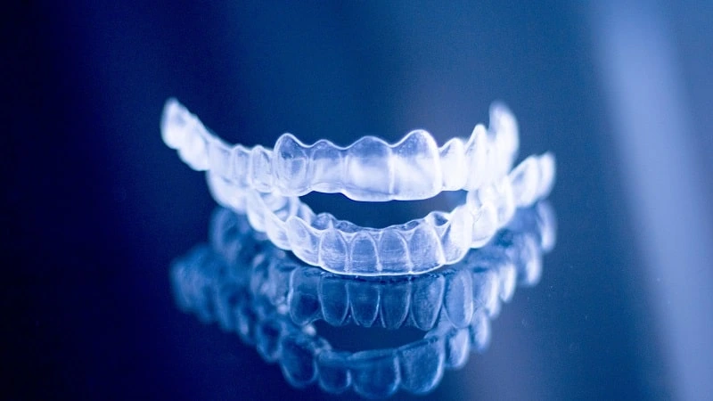 do you need braces before veneers