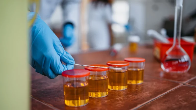 can labs tell the difference between real and synthetic urine