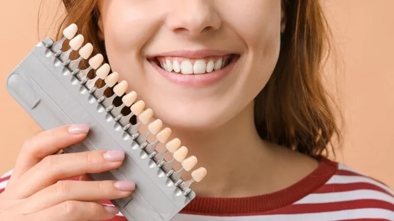 do you have to brush veneers