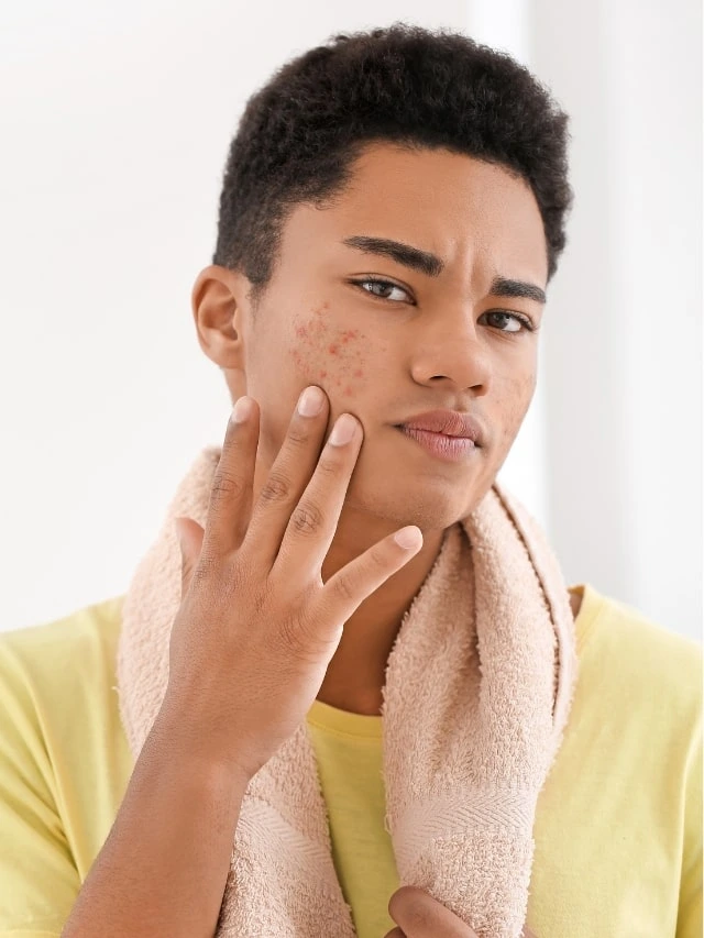 Acne bacteria trigger cells to produce fats, oils and other lipids essential to skin health